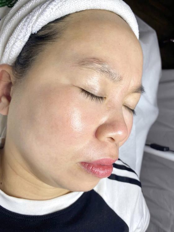 Kết quả khách hàng liệu trình nám