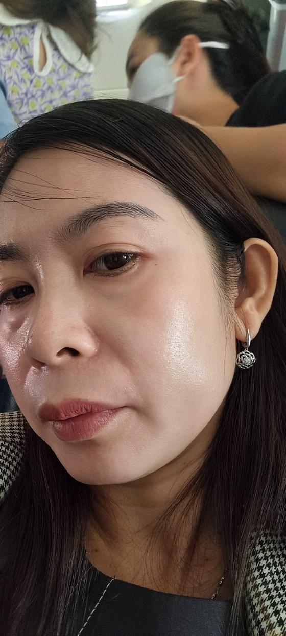 Kết quả khách hàng liệu trình nám