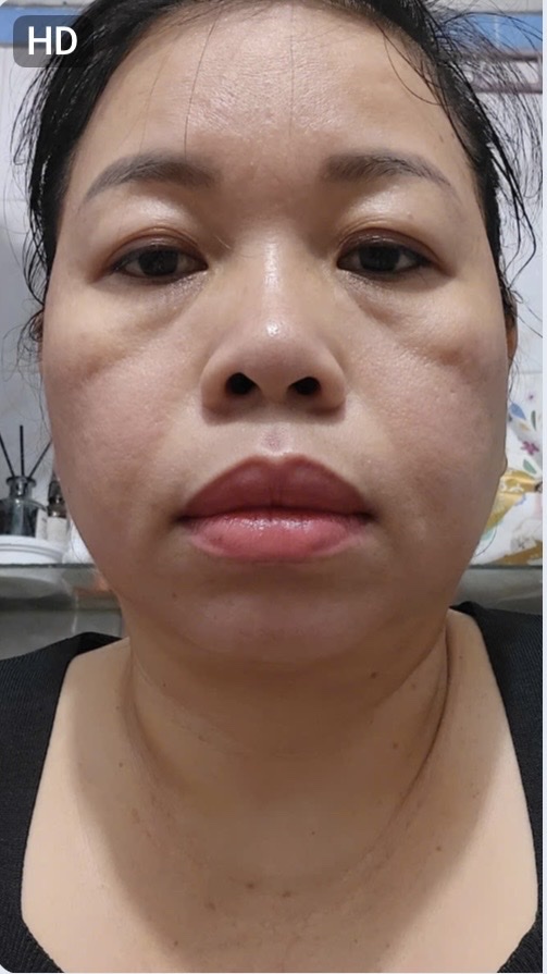 Trước
