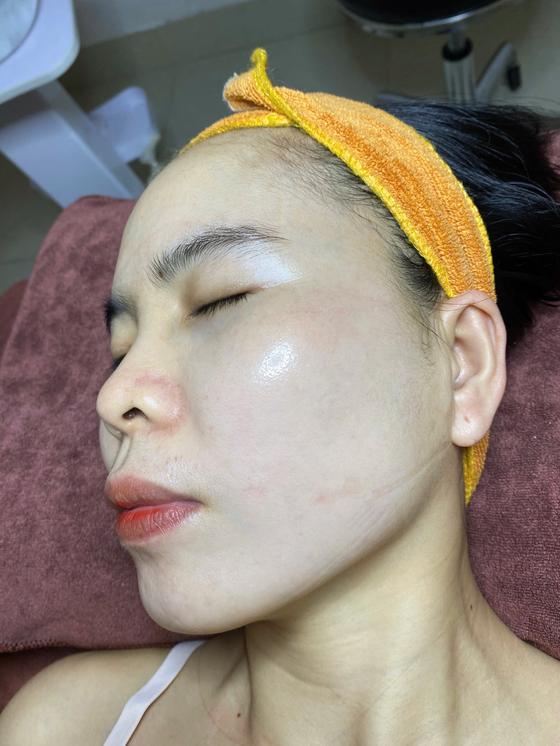 Kết quả khách hàng liệu trình nám