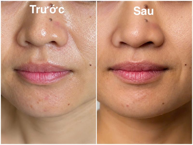 Kết quả khách hàng
