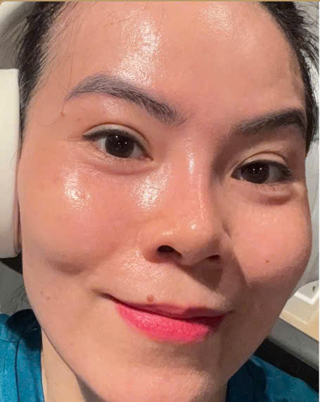Trước